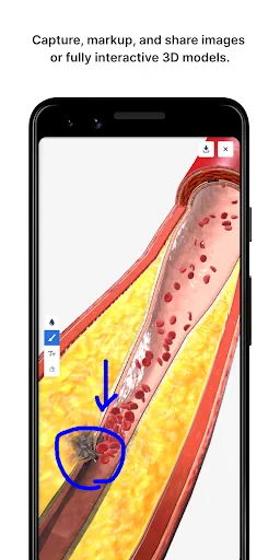 BioDigital Human ডাউনলোড করুন – সেরা 3D অ্যানাটমি লার্নিং অ্যাপ - Screenshot 5